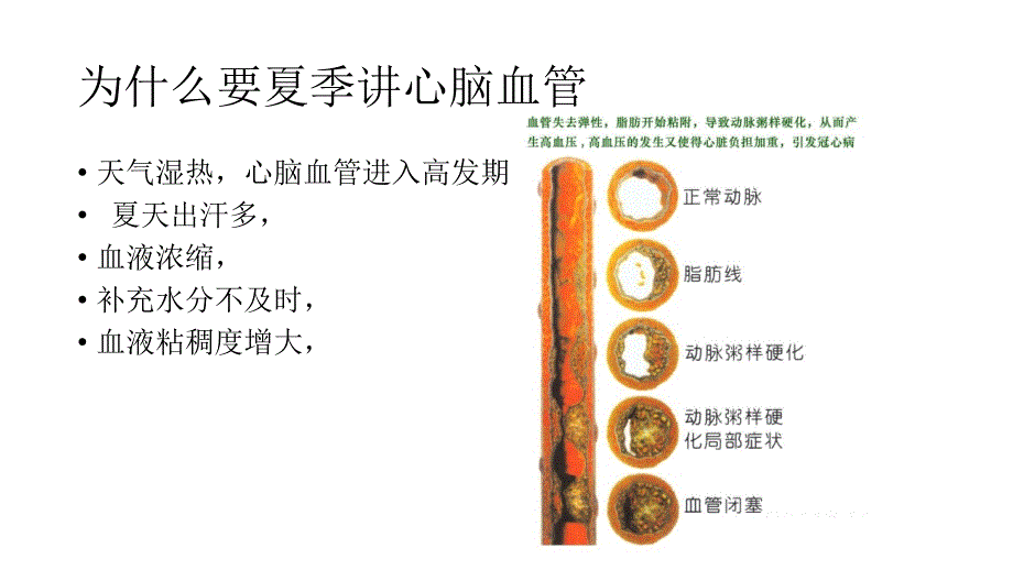 心脏病是心脏疾病的总称PPT课件.ppt_第2页