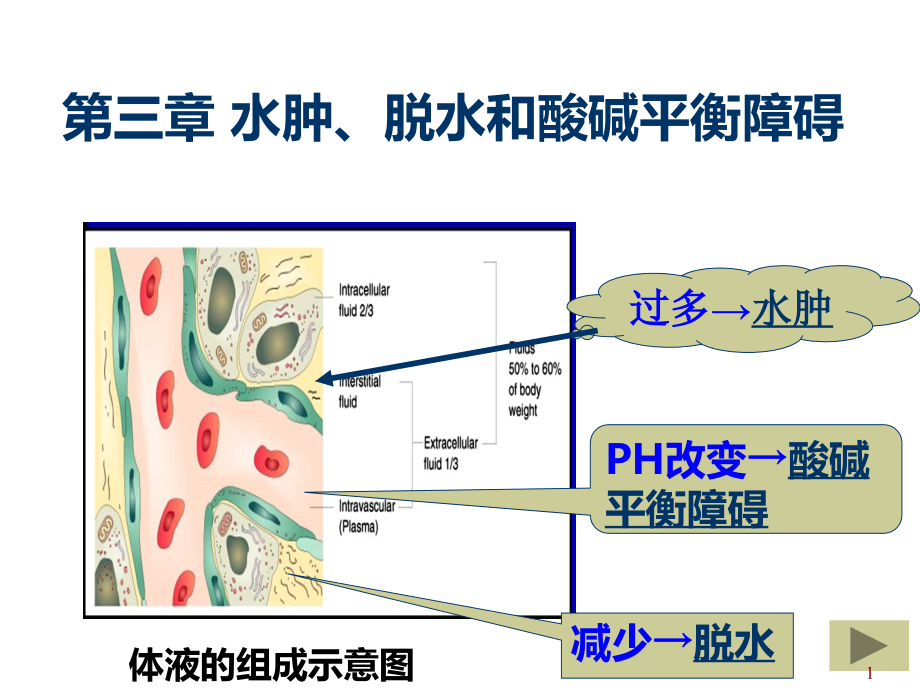 水肿和脱水PPT课件.ppt_第1页