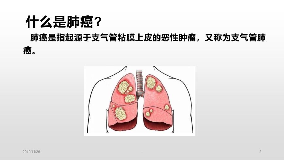 肺癌的现代预防和治疗PPT课件.ppt_第2页