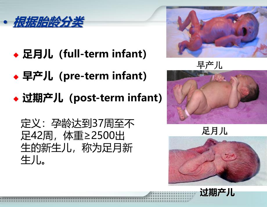 新生儿及新生儿疾病患儿的护理PPT课件.ppt_第3页