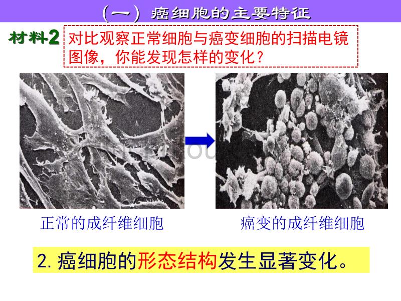 内蒙古高一生物课件：必修一 6.4 细胞的癌变_第4页