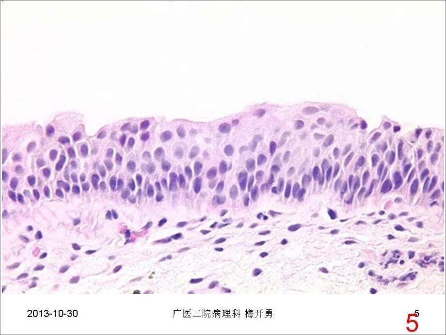 子宫内膜出血PPT课件.ppt_第5页