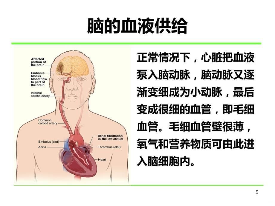 脑卒中的基础知识(社区宣教版)PPT课件.ppt_第5页