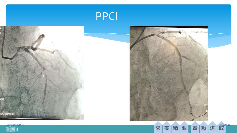 胸痛中心建设与转诊流程PPT课件.ppt_第3页