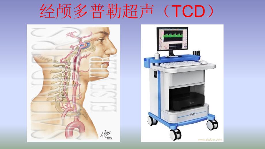 8、孟军——TCD常用参数及颅内动脉识别（12.11）_第3页