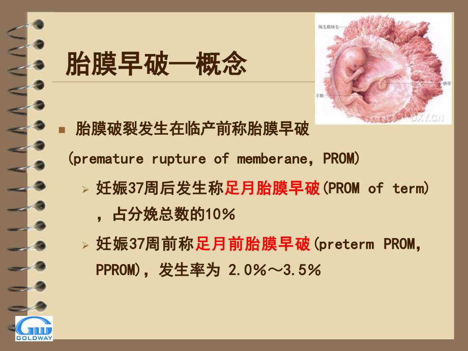 胎膜早破 (2)_第4页