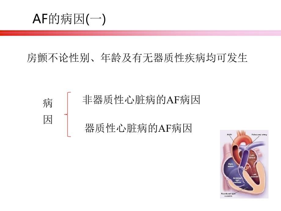 房颤的原因及处理整理.ppt_第5页