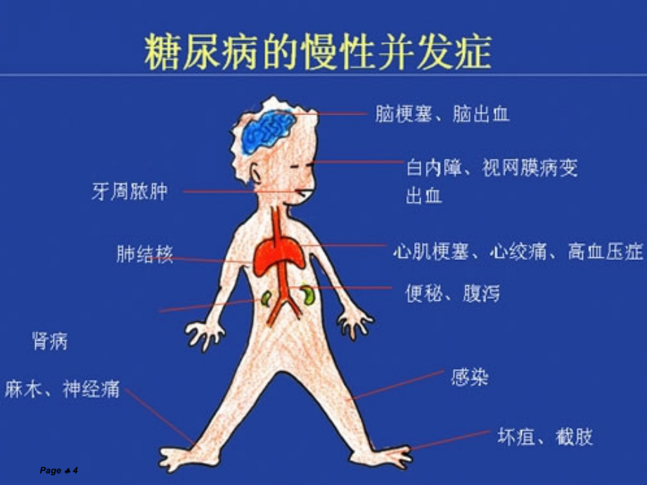 糖尿病预防诊断治疗ppt课件.ppt_第4页