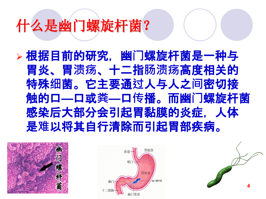 幽门螺杆菌感染的规范治疗ppt课件.pptx_第4页