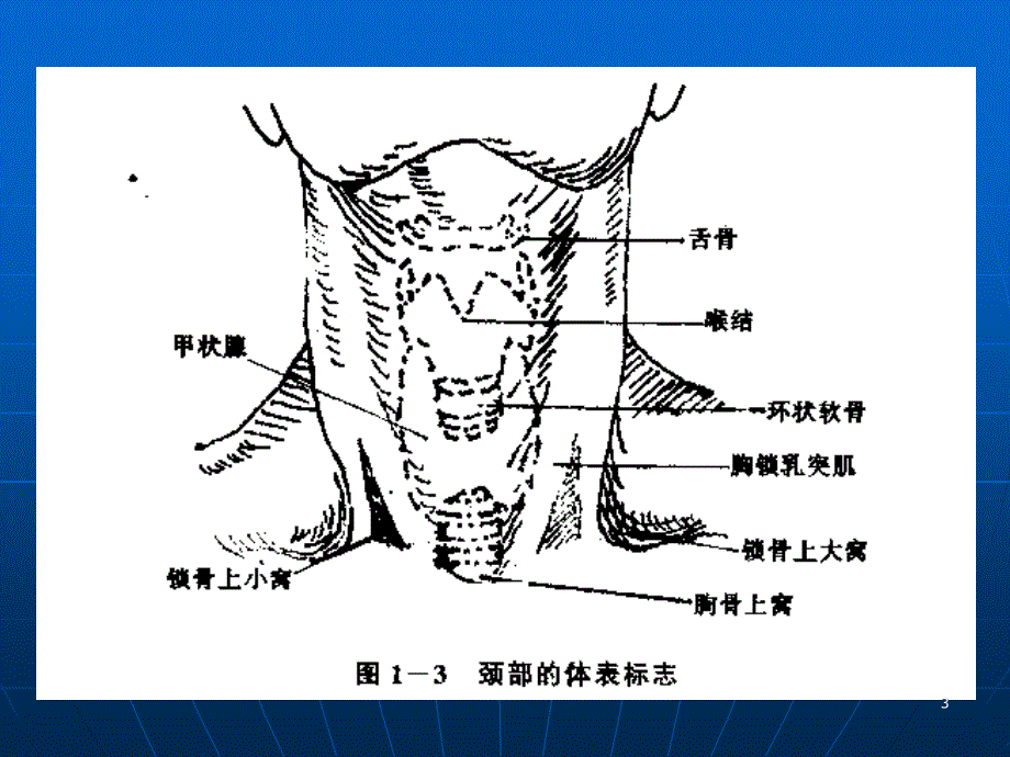 锁骨下静脉穿刺图ppt课件.ppt_第3页