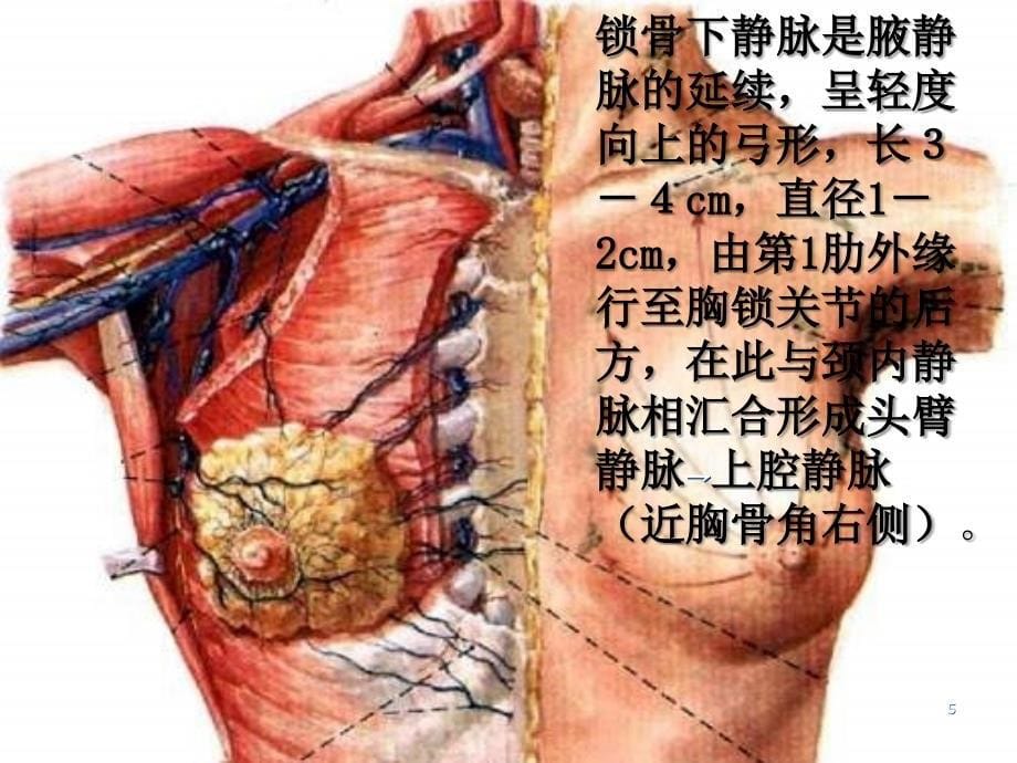 锁骨下静脉穿刺图ppt课件.ppt_第5页