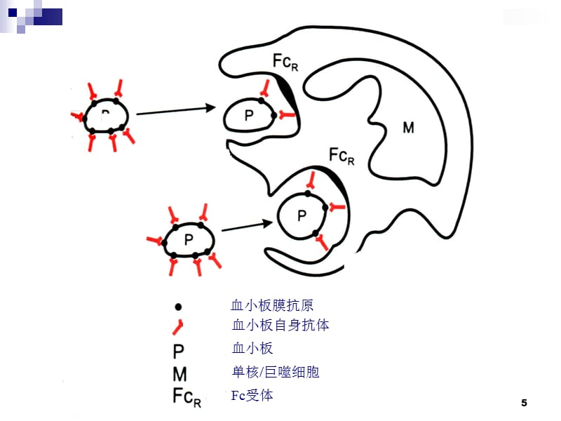 特发型血小板减少性紫癜ppt课件.ppt_第5页