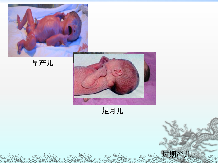 新生儿常见急症ppt课件.ppt_第3页