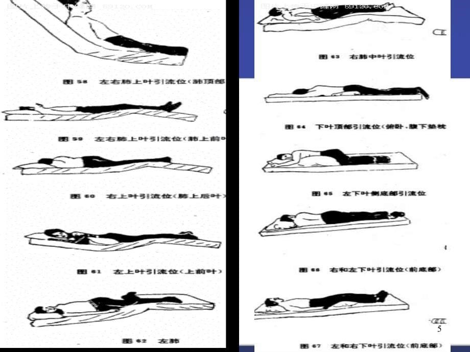 呼吸内科常用操作技术ppt课件.ppt_第5页