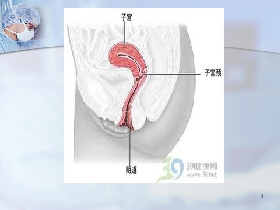 阴道出血ppt课件.ppt_第4页