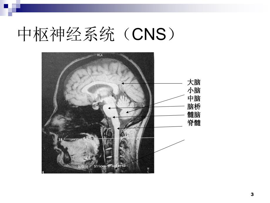 大脑血管解剖ppt课件.ppt_第3页