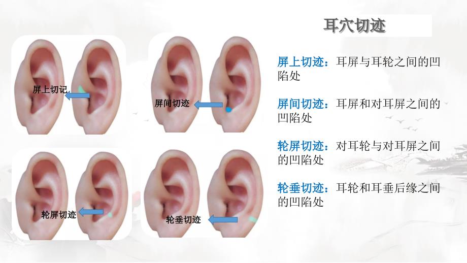 神奇的耳穴疗法-穴位篇.ppt_第4页