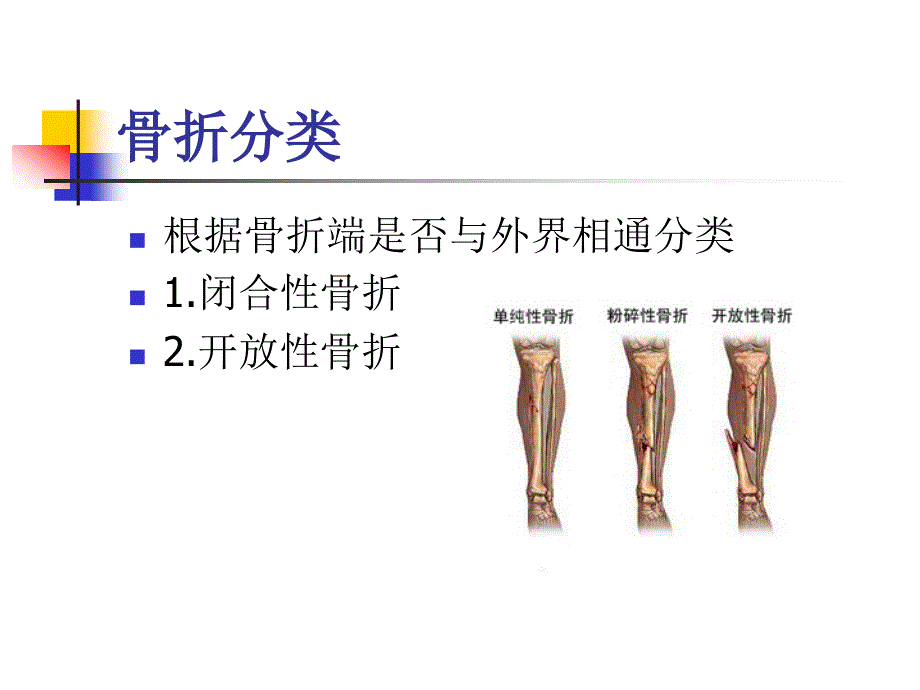 骨折病人护理__第4页