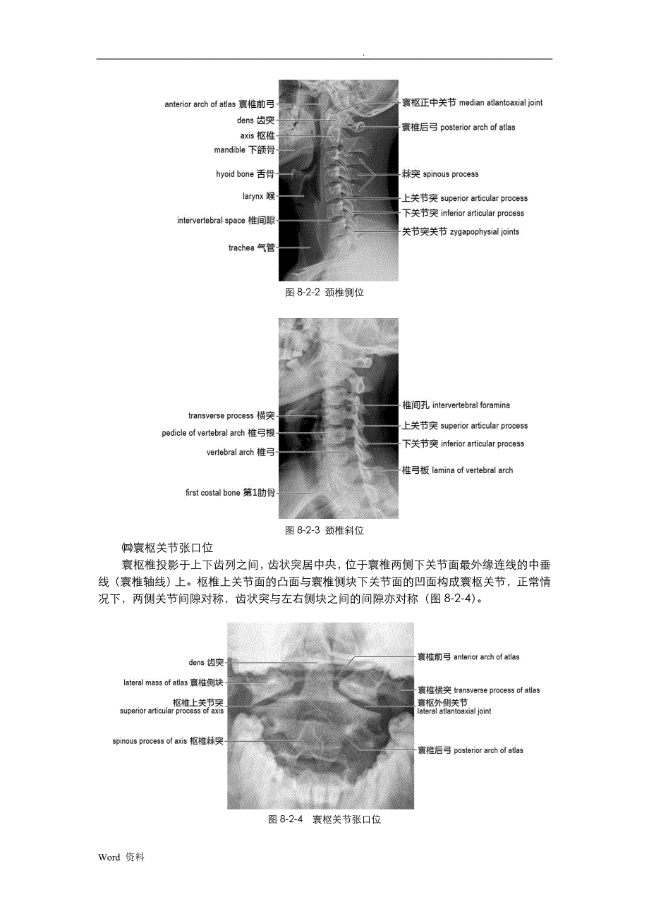 脊柱和脊髓影像解剖_第4页