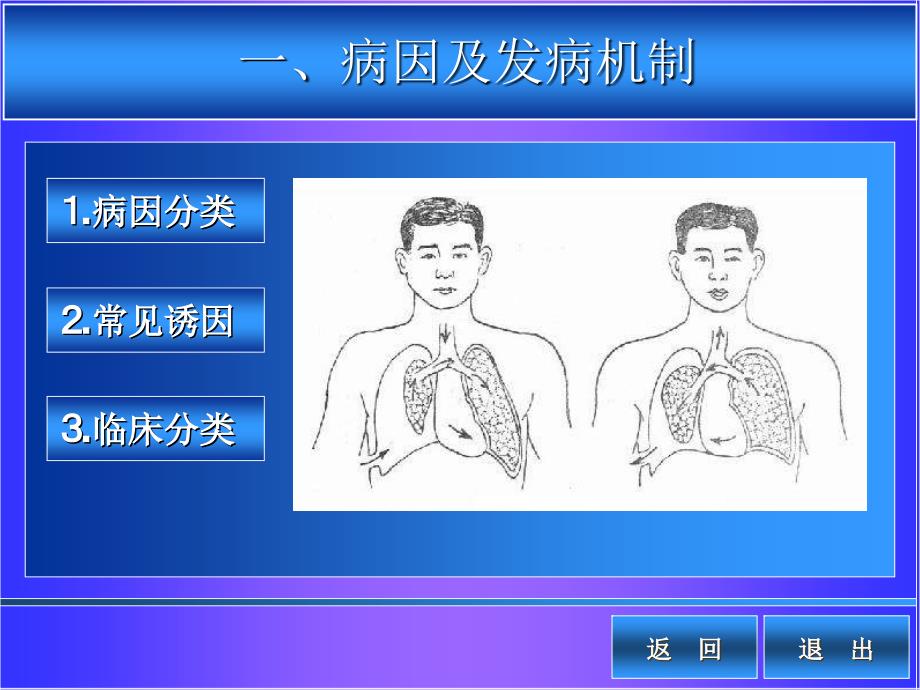 自发性气胸病人的护理可编辑.ppt_第3页