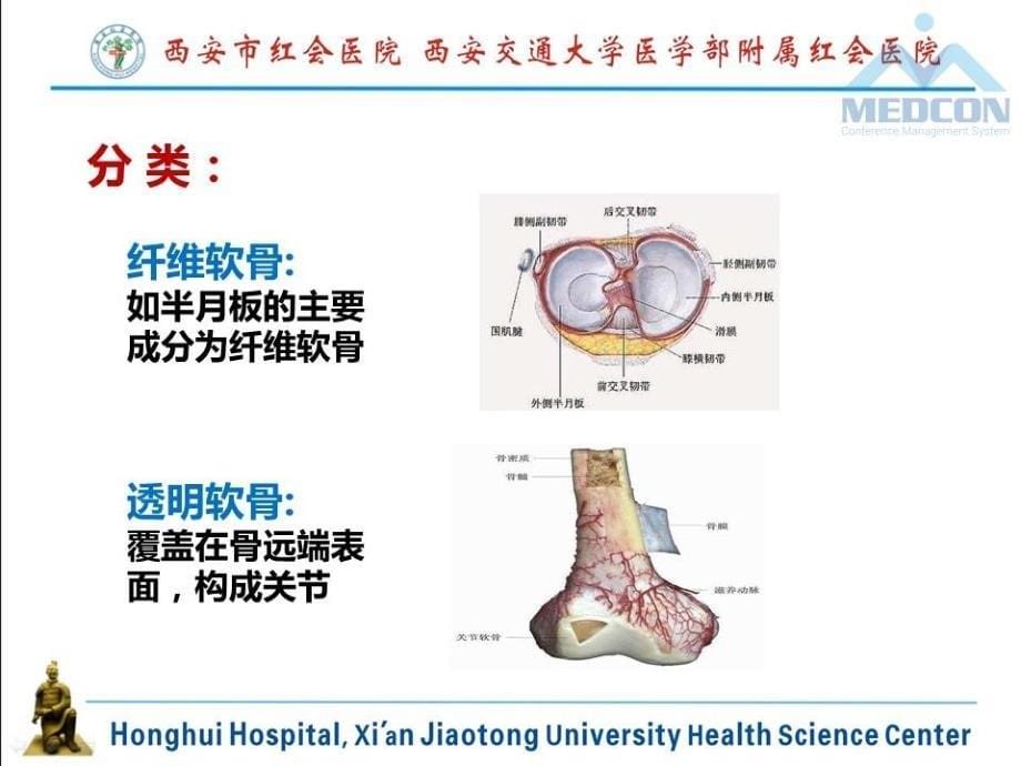 阶段式康复护理模式对膝关节软骨细胞膜片移植术康复效果_第5页