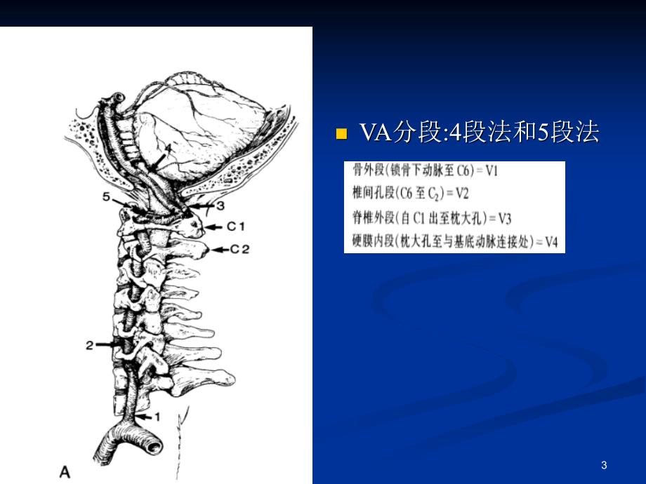 寰椎后桥PPT课件_第3页