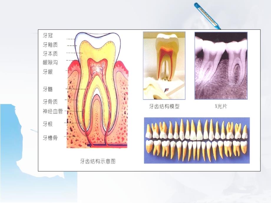 口腔常见疾病的防治PPT课件_第4页