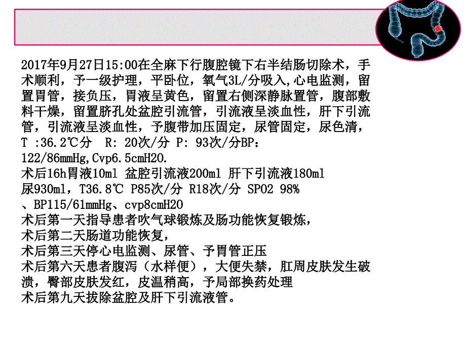 结肠癌的护理查房PPT课件_第4页