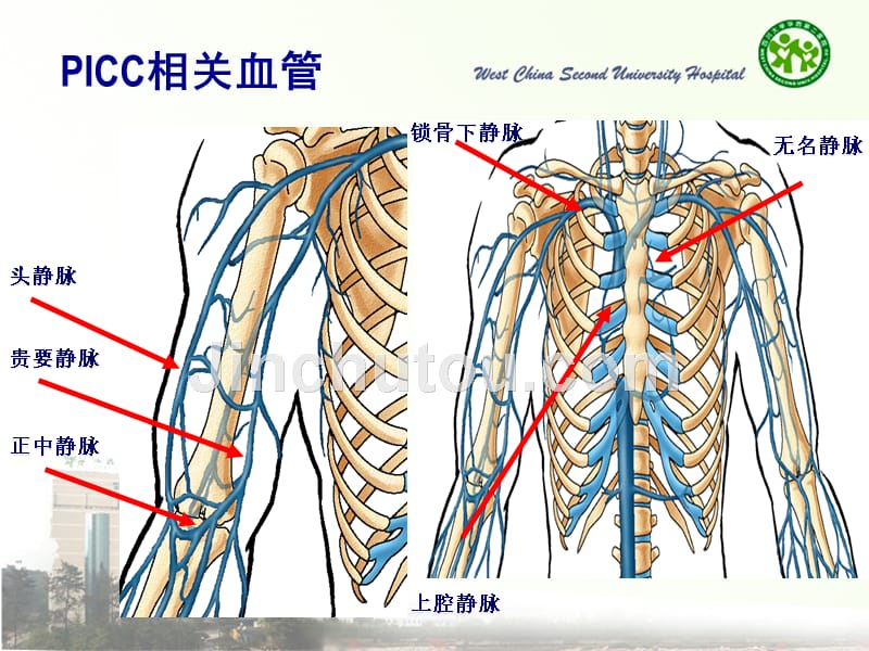 PICC导管的维护-(1)_第4页