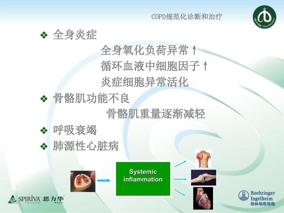 COPD的定义和发病机制.ppt_第5页