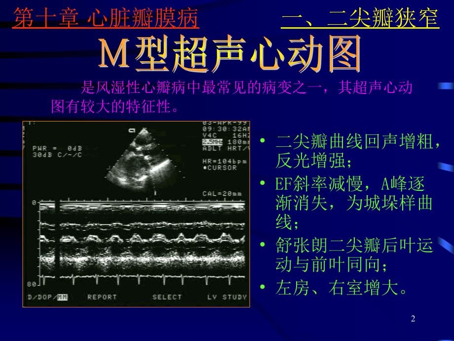 《心脏彩超诊断》PPT课件.ppt_第2页