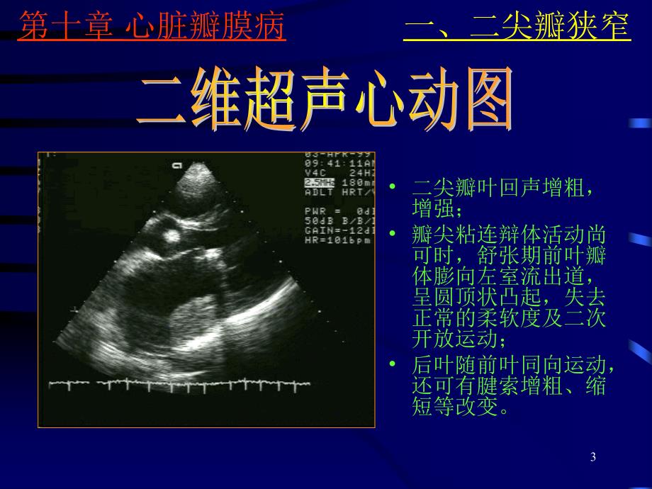 《心脏彩超诊断》PPT课件.ppt_第3页