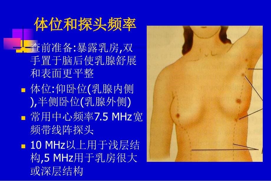 《乳腺超声》PPT课件.ppt_第5页