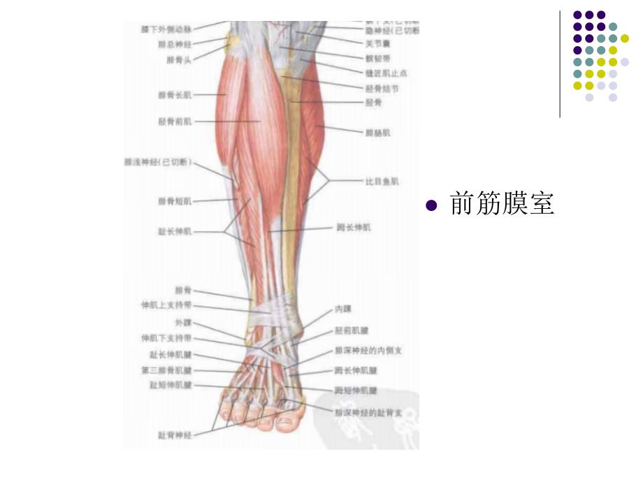 《筋膜间室综合征》PPT课件.ppt_第4页