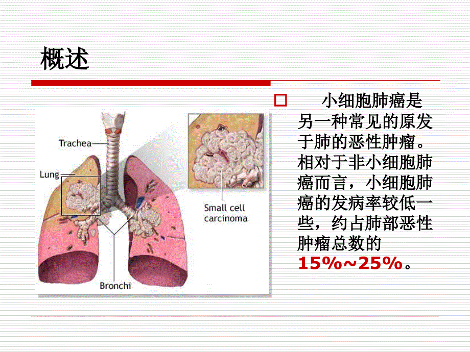 《小细胞肺癌》PPT课件.ppt_第2页
