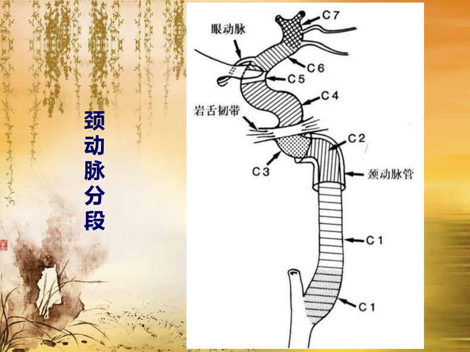 《脑动脉系解剖》PPT课件.ppt_第4页