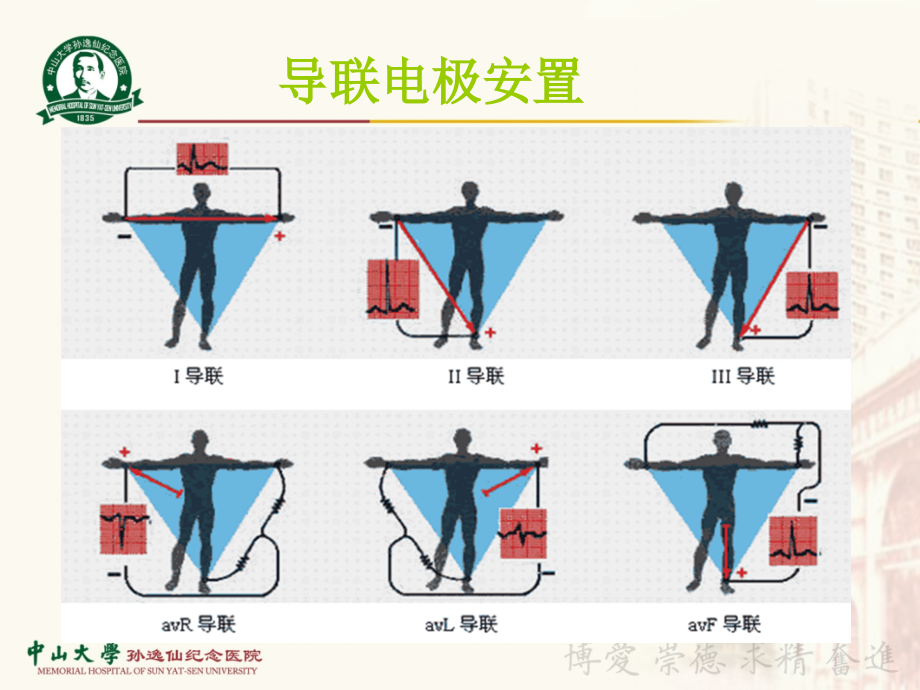 《心电图基本常识》PPT课件.ppt_第4页