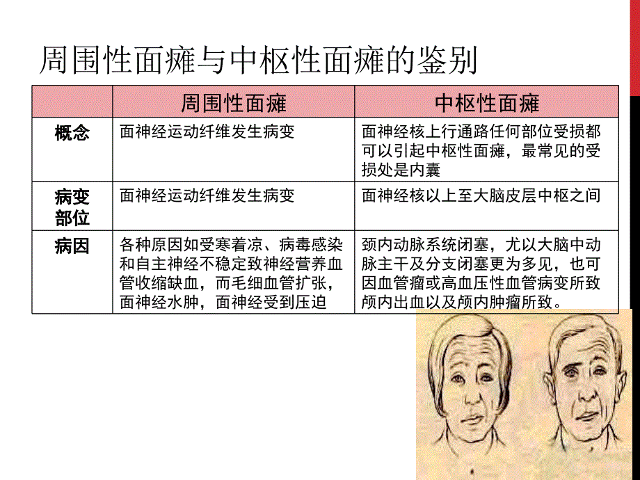 《面瘫的针灸治疗》PPT课件.ppt_第4页