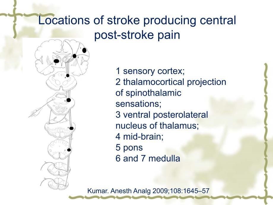《卒中后中枢痛》PPT课件.ppt_第5页