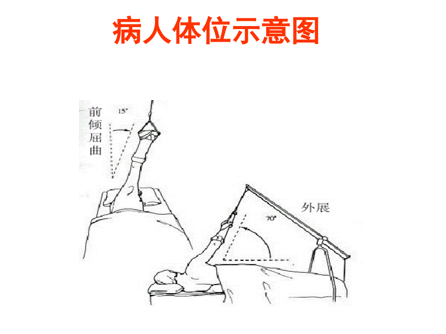 《肩关节镜简介》PPT课件.ppt_第4页