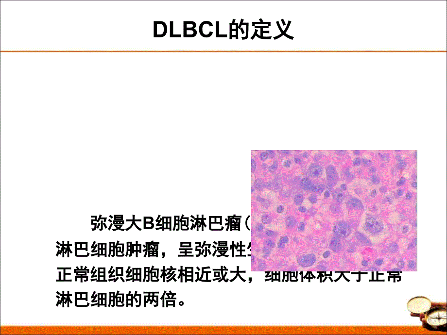 中国弥漫大B细胞淋巴瘤诊治指南.ppt_第2页