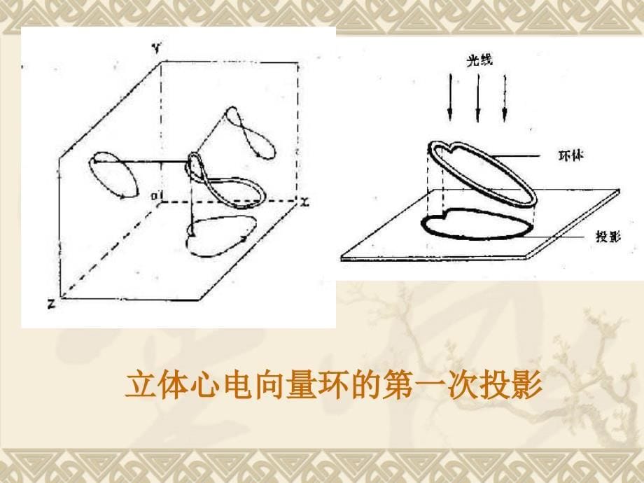 心电图-心电向量详解.ppt_第5页