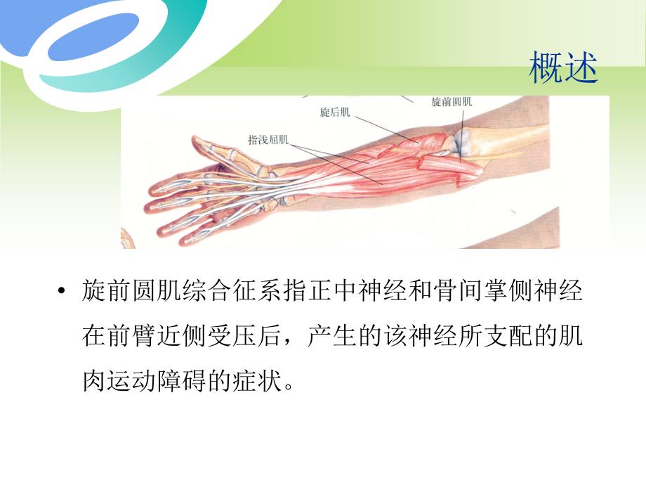 旋前圆肌综合症ppt课件.ppt_第3页