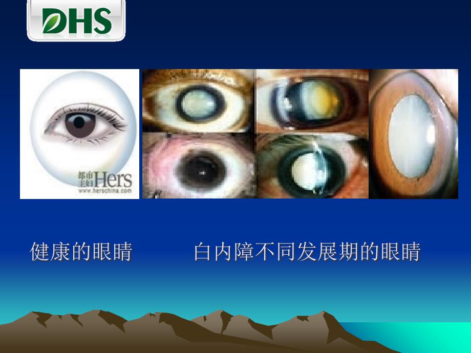 眼健康科普知识ppt课件.ppt_第4页