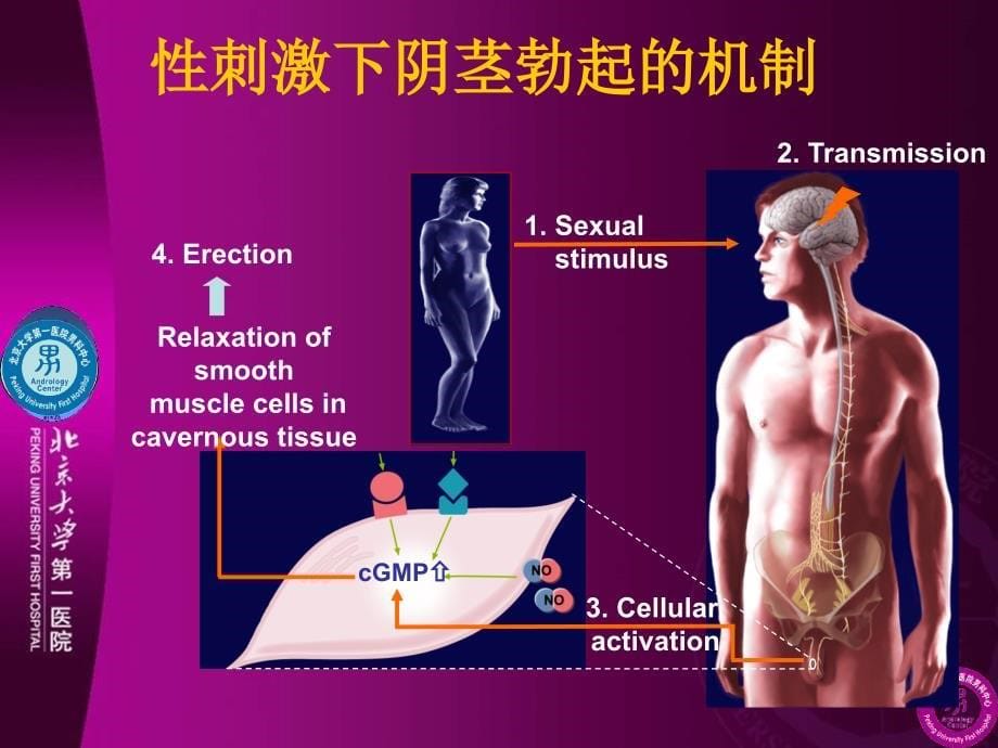 糖尿病和ED_第5页