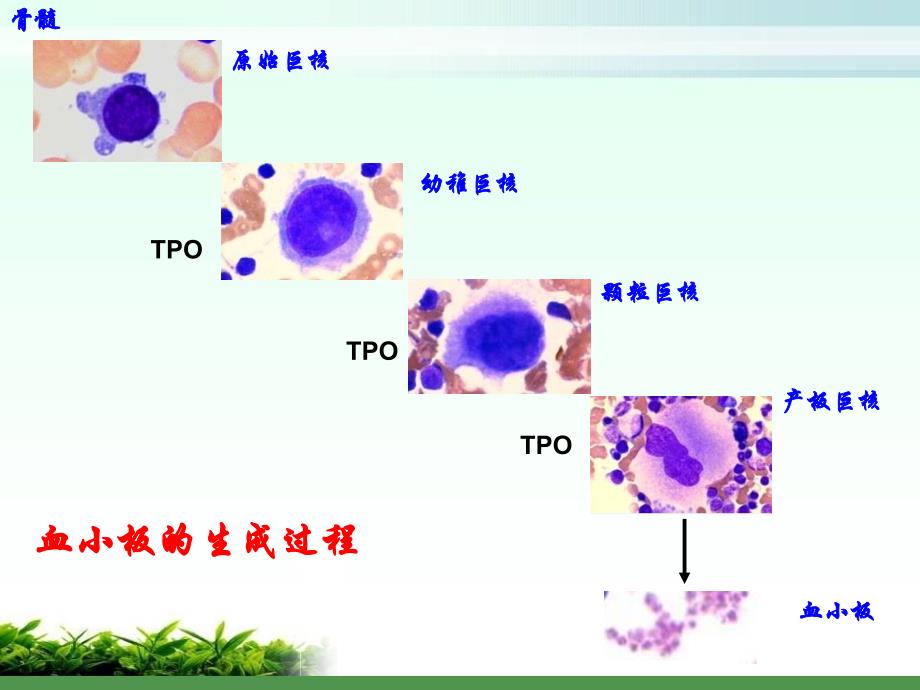 血小板减少症的诊治PPT课件.pptx_第4页