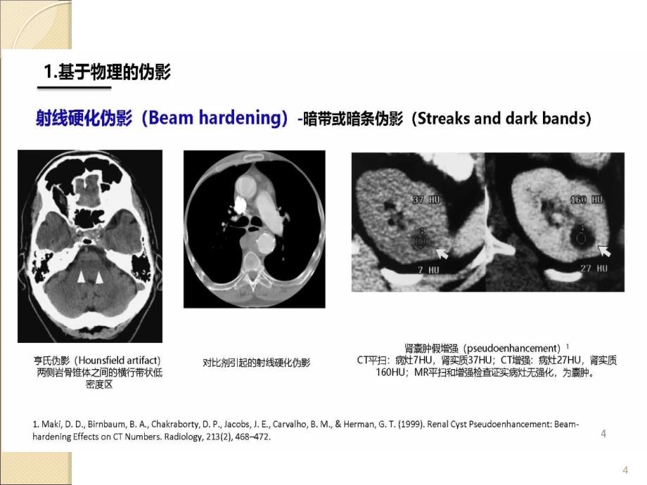 CT伪影产生机制及图像表现ppt课件.ppt_第4页