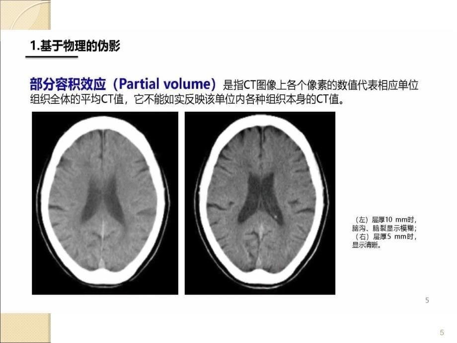 CT伪影产生机制及图像表现ppt课件.ppt_第5页