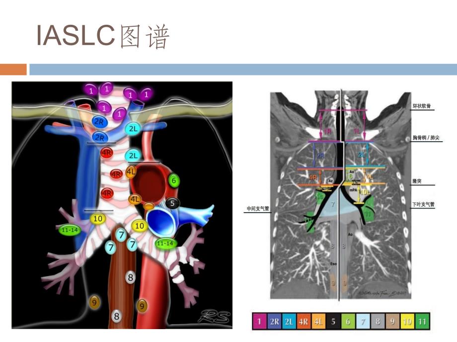 最新IASLC胸部淋巴结分组图谱解读ppt课件.pptx_第3页