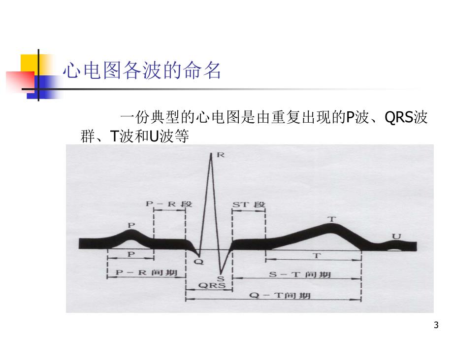 医生快速判读心电图ppt课件.ppt_第3页